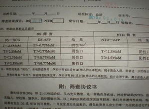 唐诗筛查多少钱 丙肝检查多少钱