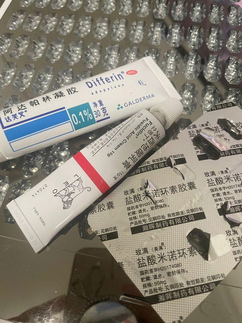 护肤分享 治炎症痘过程 