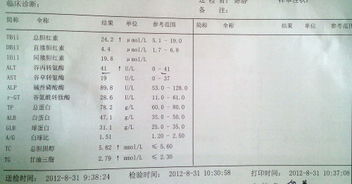 入职体检,肝功能检查 请帮忙看一看这样结果算合格吗 