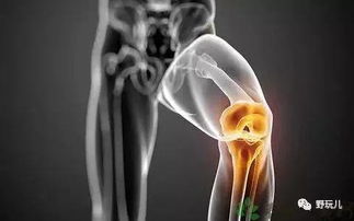 跑步膝盖痛骗了你100年 跑步才是保护膝盖的关键 