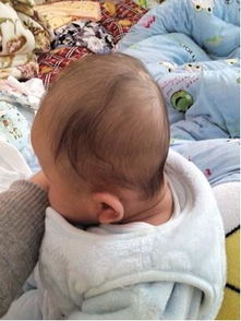 宝宝怎样睡姿势,才不会有后脑勺扁平