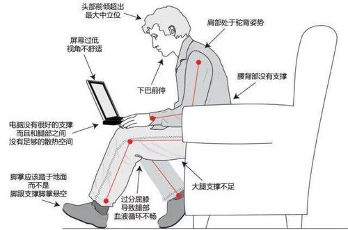 看你是否骨盆前倾,改善骨盆前倾的康复动作