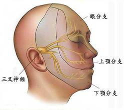 微血管减压术技术彻底治疗三叉神经痛