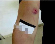 上海男子以 自残割颈 挽留女友,撕咬割伤民警 被提起公诉