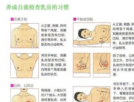 30岁女性患乳腺癌,你知道如何乳房自检吗