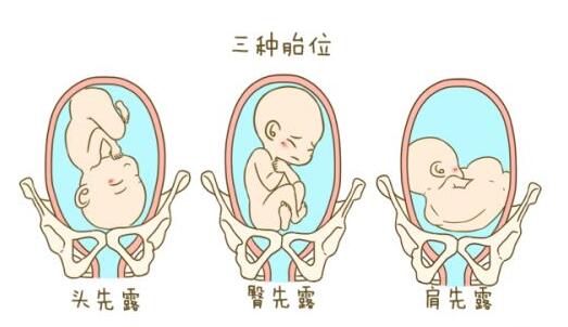原创孕妇的这4种表现，对胎儿发育不利，还易导致胎位不正