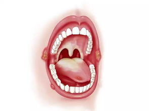 肾虚一直上火口腔溃疡,肾虚老是口腔溃疡,牙疼,这种现象属于阴虚还是阳虚问题分析口腔溃