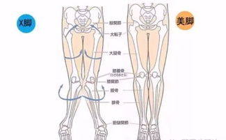 瘦腿之前,先矫正腿型,不然越练越粗