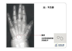 骨龄图谱2016版 最终版 
