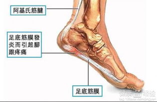 有哪些适合背筋膜炎患者的锻炼方式？