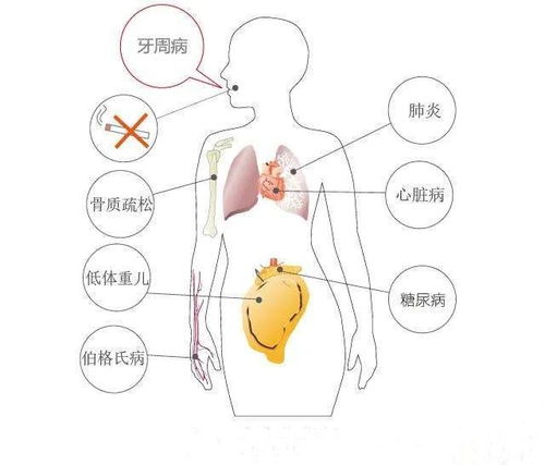 30岁的年纪,全口牙松动,年轻人应该警惕的侵袭性牙周炎