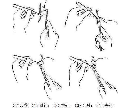 动物外科缝合方法 