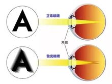 我的眼睛散光比较严重，到苏州哪家医院去治疗比较好？