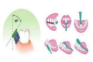 洗牙的好处有哪些 洗牙的坏处有哪些 5号网 