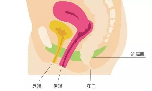 为什么要做盆底肌筛查 产后两年了做盆底康复有用吗