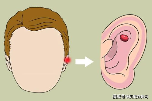 耳朵总是嗡嗡响,是怎么回事 藏在耳鸣后面的几个问题