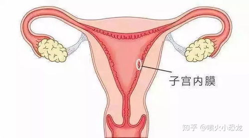 子宫内膜多厚才可以移植 子宫内膜薄该如何调理呢 关于子宫内膜的那些事都在这里面 