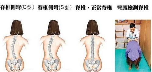 走近贝尔安亲 让孩子找回自信 青少年体态纠正课 免费体验招募中 