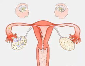 吃什么可以保养卵巢 卵巢早衰你重视起来了吗