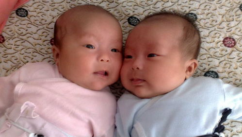 准妈妈一胎生下2个宝宝,长相一样,医生却说不是双胞胎 