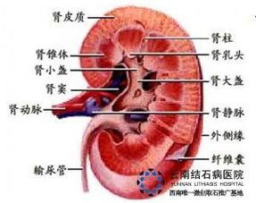 怎么治疗肾结石症状 肾结石 胆结石 保胆保肾取石 亚洲专业治疗结石病的医院 