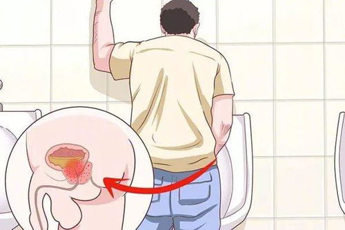 什么是尿频尿急尿不尽症状