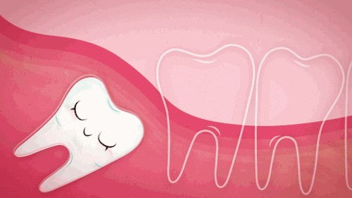 拔除智齿会影响智力 拔牙后容易嵌塞食物 关于拔牙的几个真相