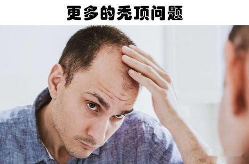 男性拥有更大的大脑,但未必更聪明 关于男性身体的5个奇妙事实