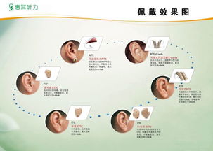 台州路桥惠耳助听器东路桥大道 数字助听器怎样才能调试出最佳效果 