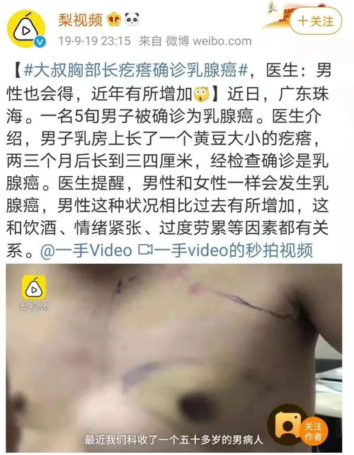 男子胸部长了个疙瘩,检查竟是乳腺癌,这些部位的疙瘩要注意