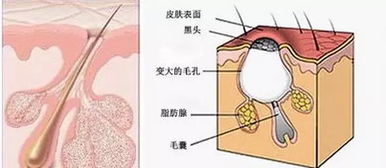 痘痘我要代表月亮消灭你