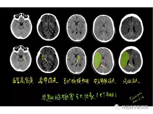 部分遗传性疾病的特异征象