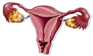 小茄解暗区突围,右侧卵巢内可见液性暗区是什么意思