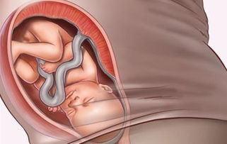 胎儿几周入盆？胎儿多少周入盆