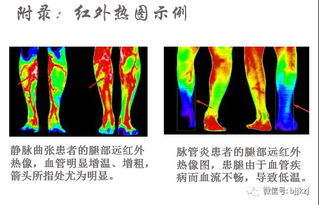 揭秘腋下测温与红外线热成像的神奇效果