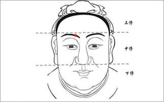 麻衣面相中的黑痣都代表了什么含义 