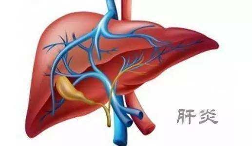 肝炎病情加重 可通过6种皮肤症状察觉