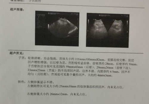 腺肌症 忍到绝经还是切除子宫 其实都没必要