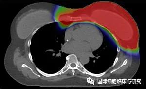 什么是质子治疗，质子治疗真的能消除癌细胞让癌症患者痊愈吗