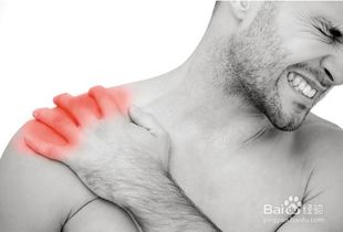 肩膀酸痛是怎么回事 
