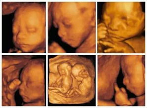 超声影像 四维彩超 胎宝宝在子宫里会感到孤独吗 
