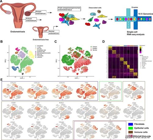 单细胞转录组测序解析子宫内膜异位症成纤维细胞命运