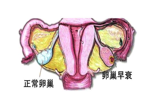 卵巢性闭经，卵巢早衰闭经能治愈吗