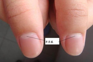 指甲有月牙就一定健康 六种指甲变化不要忽视了 
