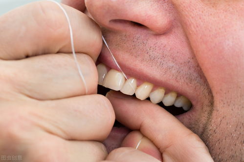 治疗牙周炎,有5个方法,日常做好5点,避免口腔问题