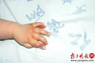 徐州粗心妈妈给10月大孩子裁剪袖口,竟剪掉了宝宝的一截手指