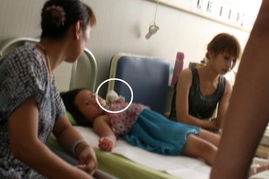 南京一4岁女孩电梯摔下 手指被切断 