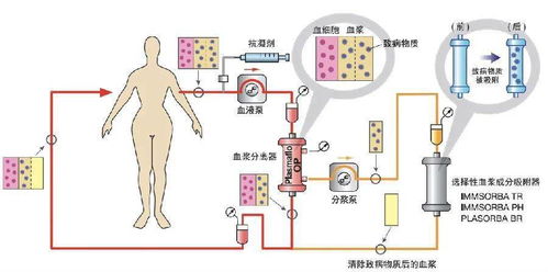 红外线热成像系统治疗时间