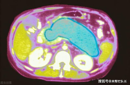 春节过后,小心这种 节日病