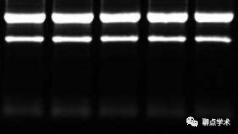 RNA电泳条带中的 28s 18s 5s分别代表什么？